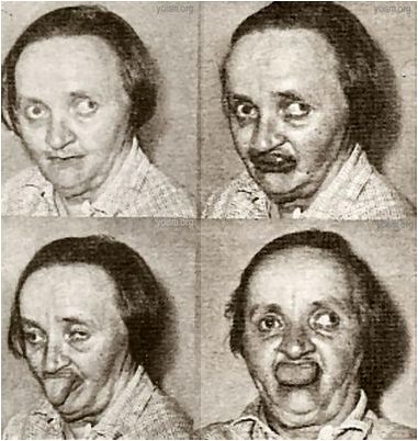 шизофрения шизофрения