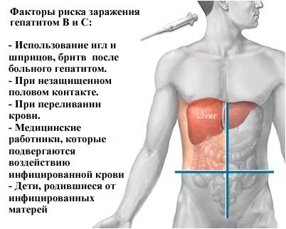 гепатит гепатит