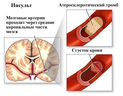 диета диета