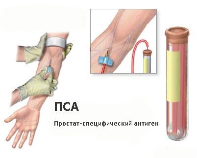 биопсия биопсия