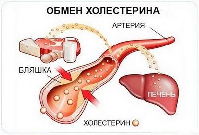 брокколи брокколи